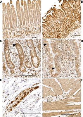 Hypoxia signaling in the equine small intestine: Expression and distribution of hypoxia inducible factors during experimental ischemia